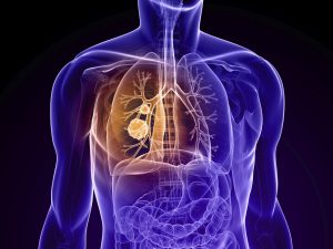 Dr. Lisa Marie Cannon Explains - How To Prevent COPD